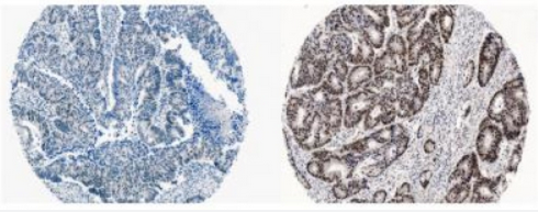 Devel&nbsp;Cell：癌基因或可被营养物所调节