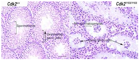 PNAS：不孕不育致病基因是哪些？