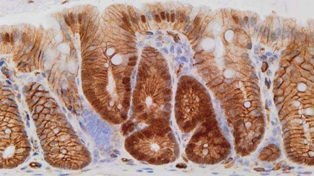 Nature&nbsp;&&nbsp;Genes&Dev&nbsp;&&nbsp;EMBO&nbsp;J：肠癌背后的基因错误