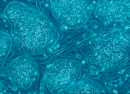 Stem&nbsp;Cell&nbsp;Rep：新型干细胞基因修饰技术或加速个体化疗法的开发