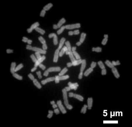 Science：染色体“绝缘区域”的改变或将激活致癌基因的表达