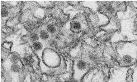 Science：首次基因组分析有助认识巴西寨卡病毒暴发