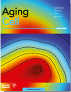 Aging&nbsp;Cell：长寿蛋白或影响许多相同基因的表达