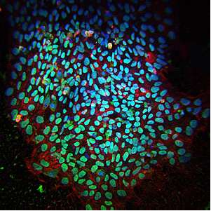 PLoS&nbsp;Genet：诱导性多能干细胞不会产生导致癌症的基因突变