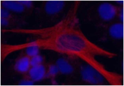 Angew&#160;Chem：利用CRISPR/Cas9让沉默基因不再沉默