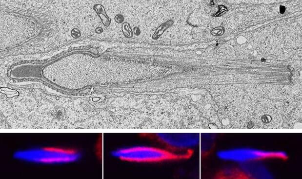 MBC：突破！科学家阐明关键基因在男性不育症中的重要角色