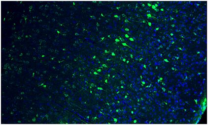 Nature：重磅！首次利用CRISPR-Cas9对非分裂细胞进行基因编辑