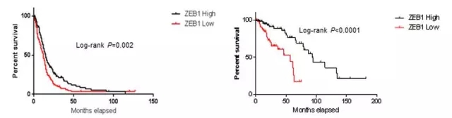 神经科学家发现控制脑瘤增长的关键基因