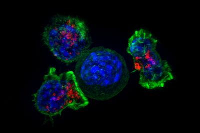 Science：CRISPR基因编辑结合离体器官构建技术帮助检测遗传性癌症特异性DNA缺陷