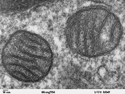 Oncotarget：预测癌症复发的新基因检测方法