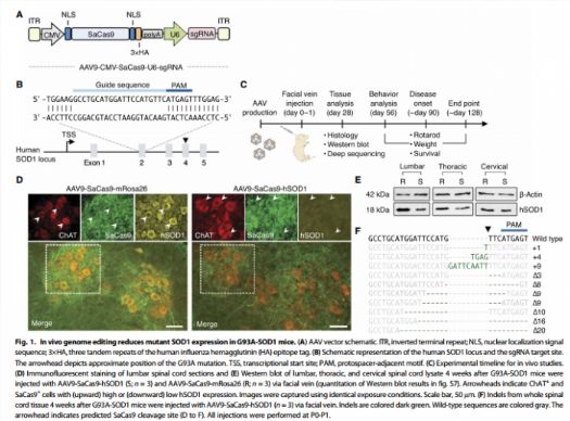 “基因剪刀”有望用于治疗渐冻症