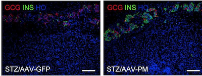 Cell&#160;Stem&#160;Cell：基因疗法能够恢复I型糖尿病小鼠的血糖水平