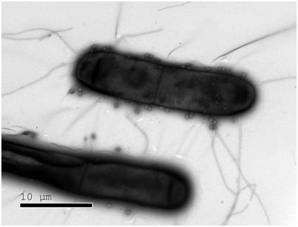 Science：发现10种新型细菌免疫防御系统，有望开发出下一代基因编辑工具