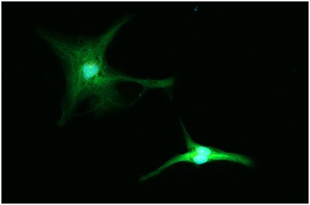 Cell&#160;Stem&#160;Cell：利用CRISPR修饰表观基因组产生诱导性多能干细胞