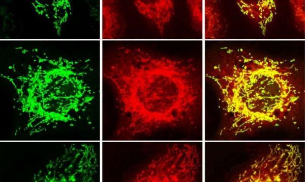 PNAS：重磅！增强特殊基因的活性有望延长机体寿命