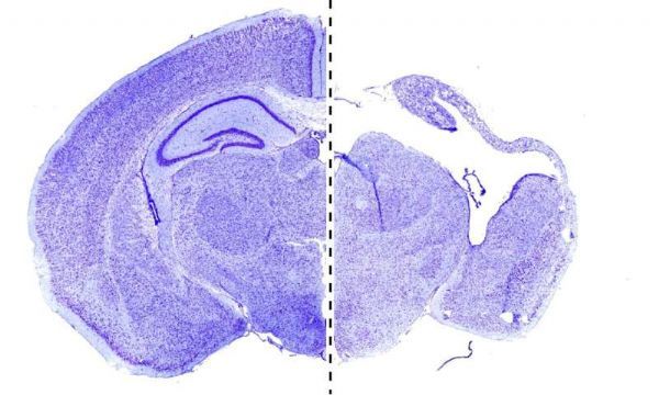 Nature&#160;Neuro重磅！研究人员发现了导致大脑发育缺陷的关键基因！