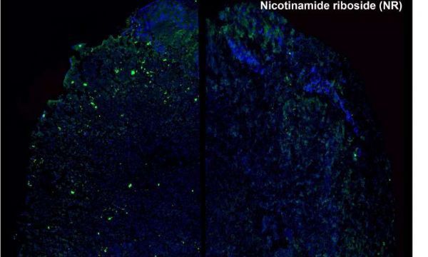 Nucleic&#160;Acids&#160;Research：研究发现线粒体基因突变与疾病之间的关系