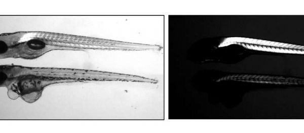 PLOS&#160;GENETICS：科学家找到控制肌肉生长和再生的基因！