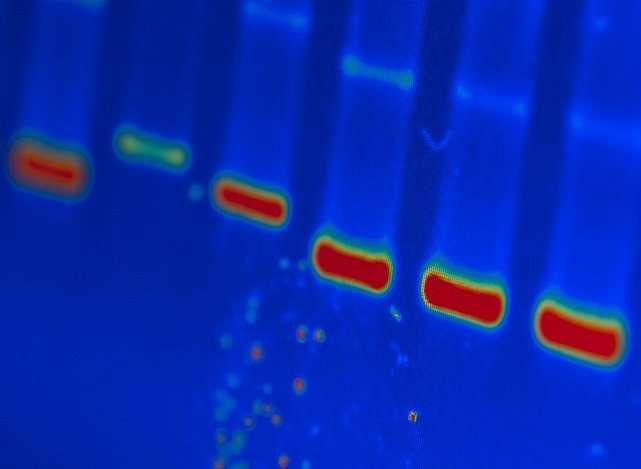 PLoS&#160;Med：新型基因评分可以预测婴儿患1型糖尿病的风险！