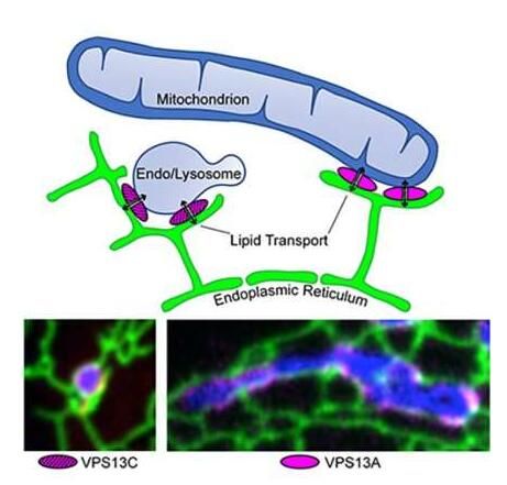 J&#160;Cell&#160;Biol：基因突变如何诱发诸如帕金森等神经性疾病的发生？