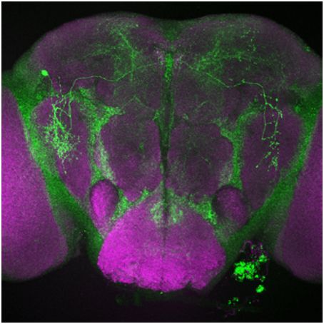 Science：重磅！新研究发现一个在患病时促进睡眠的基因