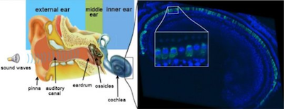 PNAS：基因疗法能够治疗小鼠先天性耳聋症状