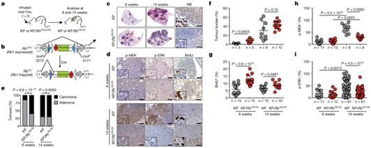 Nature：操纵肿瘤抑制基因RB有望治疗肺癌