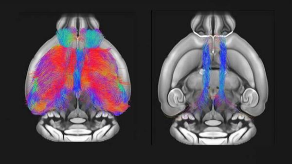 JNeurosci：自闭症基因与老鼠的大脑和行为缺陷有关