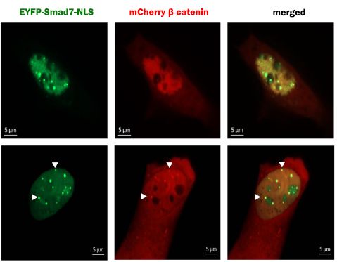 Cell&#160;Death&#160;Dis：科学家发现调节肌肉细胞的新基因