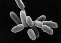 水库细菌群落分类组成与抗生素耐药功能基因变化过程研究获进展