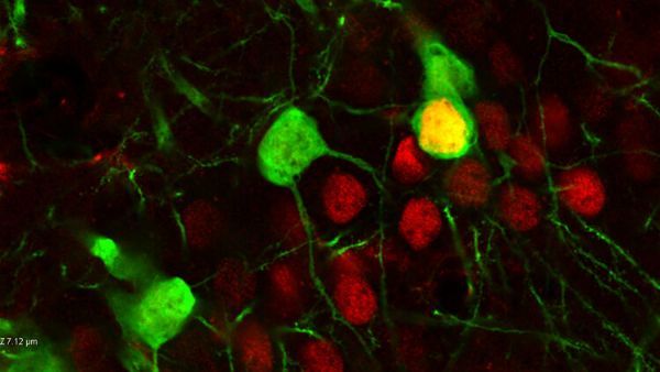 JNeurosci&#160;慢性可卡因使用可改变基因表达