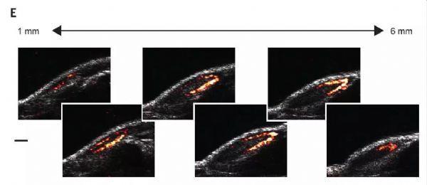 《科学》：突破显微镜的局限&nbsp;这套系统能看清体内基因表达