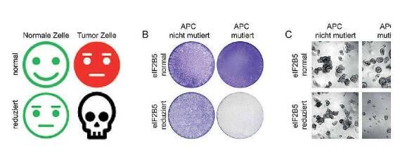 Nat&nbsp;Cell&nbsp;Biol：靶向抑制关键基因突变有望彻底根治结肠癌