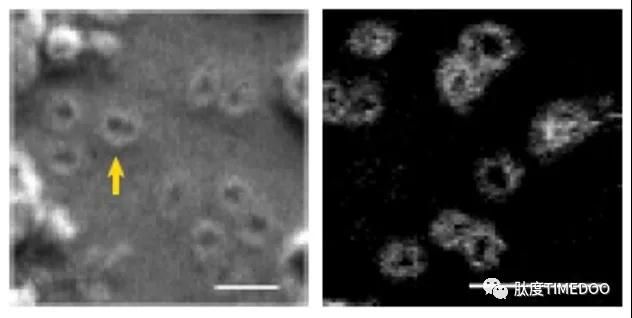 Nature重大发现：癌基因竟不在染色体上？第一作者吴思涵亲身解读！