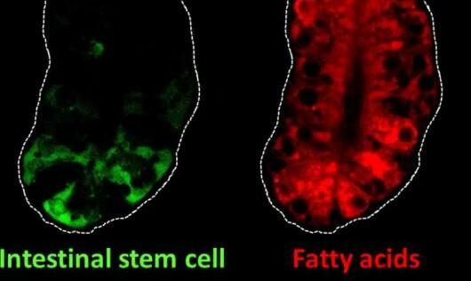 Gastroenterology：关键的肠道干细胞基因或能将膳食脂肪与结肠癌风险联系起来